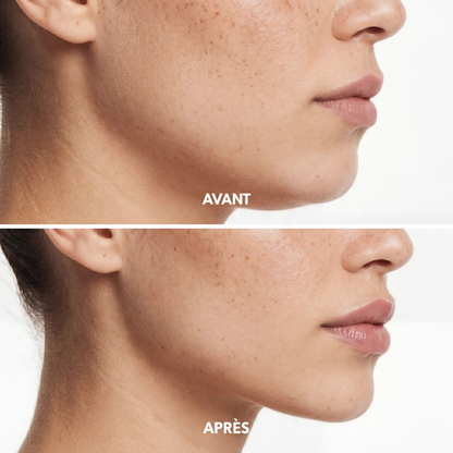 Gaine visage VEYA
