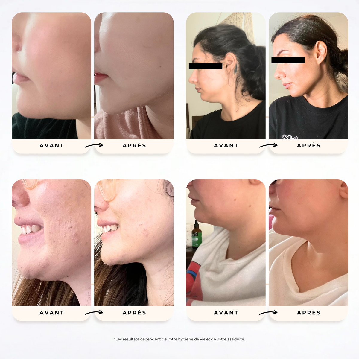 Gaine visage VEYA